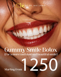 Botox for gummy smile (magic smile)