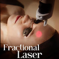 Fractional Laser