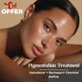 Pigmentation  Treatment