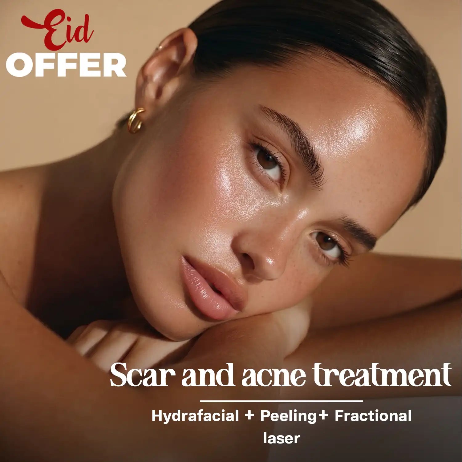 Scar and Acne Treatment