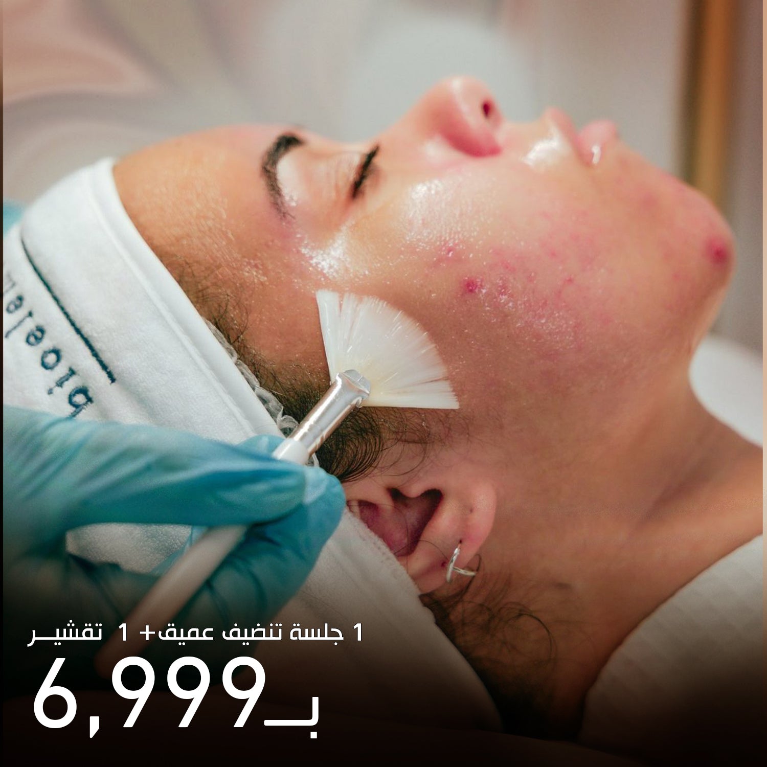 1 Session Hydrafacial + 2 Sessions Peeling