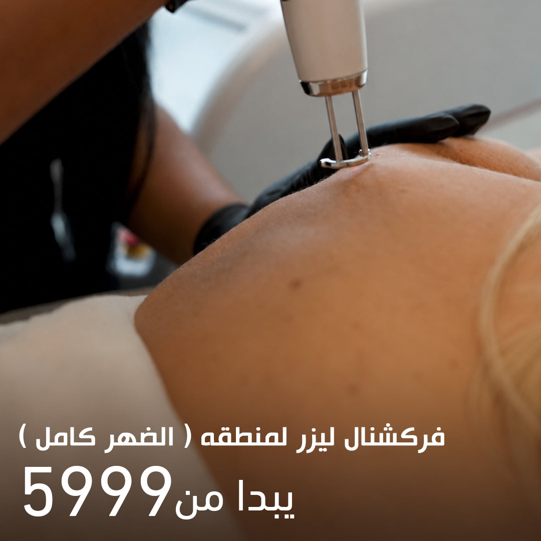 Fractional Laser for Full Back Area