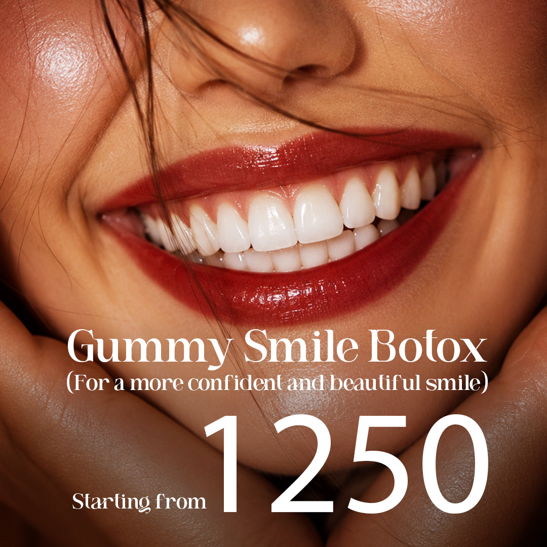 Botox for gummy smile