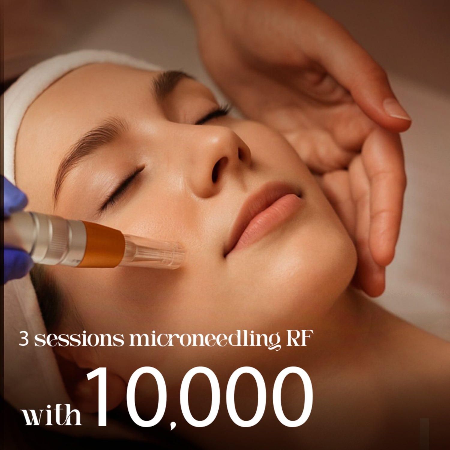 3 Session Microneedling RF