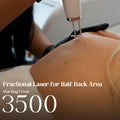 Fractional Laser for Half Back Area