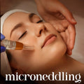 Microneddling